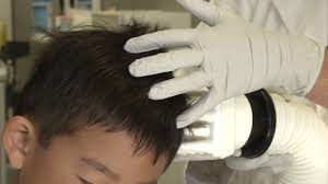 Arques ave., sunnyvale, ca 94085. Sunnyvale S Nitzy S Beauty Salon Uses New Technology To Kill Head Lice Abc7 San Francisco