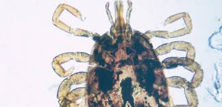 La maladie de lyme, ou borréliose de lyme, est transmise lors d'une piqûre de tique infectée par une bactérie de la famille des spirochètes. Maladie De Lyme Quand Les Tiques Attaquent Sciences Et Avenir