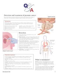 Understanding Mens Health Flip Chart