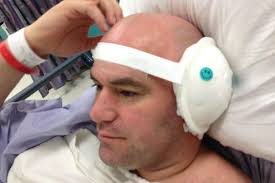 Dana White's Meniere's Disease Cure