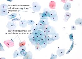 Immature squamous metaplasia (see comment) 9b Normal Cytology And Benign Reactive Changes Eurocytology