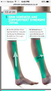 Kinesio Tape For Compartment Syndrome Compartment Syndrome Kinesio Taping Kinesiology Taping