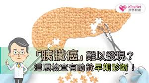 年齡：胰臟癌大部分發生在 60 歲以上，較少低於 40 歲。 èƒ°è‡Ÿç™Œ é›£ä»¥ç™¼ç¾ é€™é …æª¢æŸ¥æœ‰åŠ©æ–¼æ—©æœŸè¨ºæ–· å¥åº· Kingnetåœ‹å®¶ç¶²è·¯é†«è—¥ Second Opinion