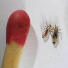 Home Remedies For Head Lice Health24
