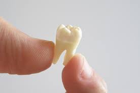 Sonhar Com Dente Caindo Teu Sonhar Como o arrancar o dente pode significar o deixar algo ou perder algo, fique mais próximo de seus familiares ou amigos para perceber como pode ajudar. sonhar com dente caindo teu sonhar