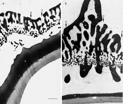 Image result for Macledium sessiliflorum