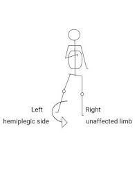 Hemiplegic Gait I Circumduction Gait Physiotherapy Mx Physio Study Physiotherapy Gait Training Physical Therapy