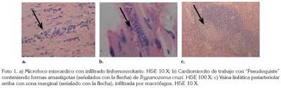 Journal of the american college of cardiology vol. Vista De Aproximacion Diagnostica Histopatologica A La Cardiomiopatia Chagasica Cronica En Saguinus Leucopus Dentro De Programas De Rehabilitacion Y Reintroduccion Revista U D C A Actualidad Divulgacion Cientifica