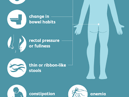 What should i know about cancer? Rectal Cancer Symptoms And Signs