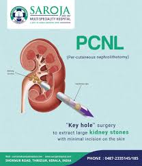 We Offer Key Hole Surgery To Extract Large Kidney Stones With Minimal Incision On The Skin Sarojamultispeciali Medical Specialties Kidney Health Health Care