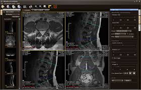 The features of these dicom viewer software is that they are suited for patient cds/dvds. Weasis Multipurpose Standalone And Web Based Dicom Viewer Linuxlinks