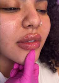 Vanessa Injects Houston Review