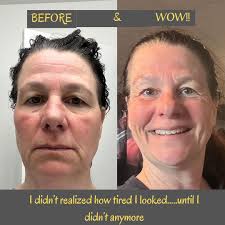 Start now and you'll be 29 days ahead of everyone who starts January 1st  🫶🏻 This comparison picture is so much deeper than the physical changes—  to be honest I couldn't tell