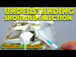 Image result for Shoulder Injection