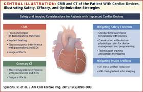 The first part consists of a brief rehearsal of the basics of cardiac automaticity, action potentials, and pacemaker cells. Cmr And Ct Of The Patient With Cardiac Devices Safety Efficacy And Optimization Strategies Jacc Cardiovascular Imaging