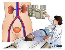 Image result for Intravenous Pyelogram