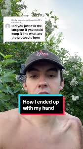 Replying to @ashleyschwedel635 How kaleb got his hand… spilling the beans  here. Don’t come after me im just a guy who wanted his own hand 🤷🏻‍♂️ and  i got it #amputee #amputeelife #hand #myhand #yes ...