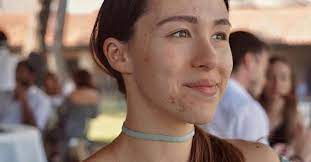 Aurora ramazzotti is a well known tv show host. Aurora Ramazzotti Has Beaten Acne The Post Curler Ruetir