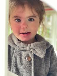 🎗️✨ HAPPY RARE DISEASE DAY 2025! ✨🎗️ Today, we stand together to honor  the incredible strength of the rare disease community