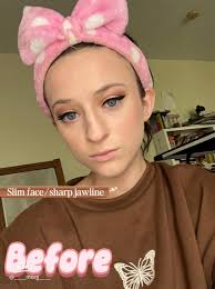 Understanding Lexapro Weight Gain: My Experience