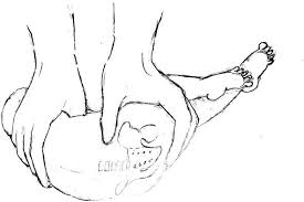 Be frugal with the wheal. Lumbar Puncture Of The Newborn Intechopen