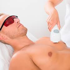 Depilación Láser en Palma