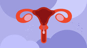 A cervical polyp is a growth that develops on the cervix, which is the canal connecting the uterus to the vagina. What Is A Cervical Polyp Symptoms Causes Treatments