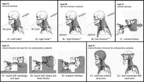 Flexion vs extension soft tissue lateral neck , w. The Ability Of External Immobilizers To Restrict Movement Of The Cervical Spine A Systematic Review Springerlink