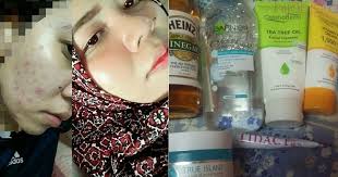 Bila pori2 besar, mekap pun tak smooth, tak cantik kan? Gadis Ini Kongsi Cara Paling Berkesan Bagi Hilangkan Jerawat Halus Parut Kecilkan Pori Wajah Hijabista