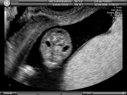 The staging is slightly different for each type of head and neck cancer. Neck Ultrasound Vikas Diagnostics