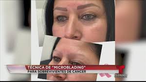 Ayudando a pacientes y sobrevivientes de cáncer