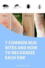 Use insect repellents, such as deet, on clothing and footwear. Pin On Health Tips