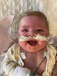 Today is National Zipper Day, and while it may not have started to honor  the scars from heart surgery, it holds deep meaning for families like ours  affected by CHD. Emmett bravely