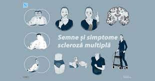 Care este cauza aparitiei sclerozei multiple? Scleroza MultiplÄƒ Ce Este Cum Se DiagnosticheazÄƒ È™i TrateazÄƒ Raportul De GardÄƒ
