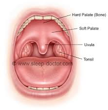 Image result for Tonsillectomy