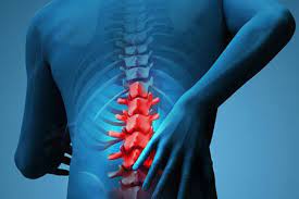 Rasa sakit di punggung bagian atas mungkin disebabkan oleh gangguan pada aorta, tumor di dada dan peradangan tulang belakang. Obesitas Sebabkan Nyeri Tulang Belakang