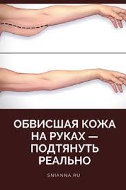 как избавиться от пигментных пятен на руках народными средствами Pin By Svetlana Orumbaeva On Kolace Natural Therapy Body Health Beauty Hacks