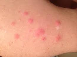 The 3 Step Free Guide On How To Check For Disgusting Bed Bugs The Sleep Judge