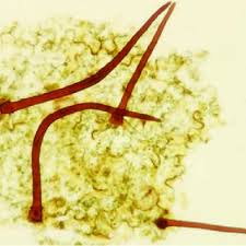 Image result for Zygophlebia villosissima