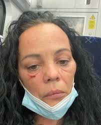 Racist thug assaults mum and child outside Glasgow Stormzy gig