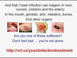 %# recurring male yeast infection causes. T Male Yeast Infection Zones Mzpx Shulman Pro