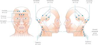 Le visage offre un air frais, sans perdre son caractère vivant et expressif. Injections Esthetiques Botox Et Acide Hyaluronique Pour Les Rides Du Visage A Geneve