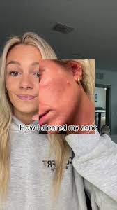 Kiara Greens: Skin Clearing & Bloating Relief Testimonial