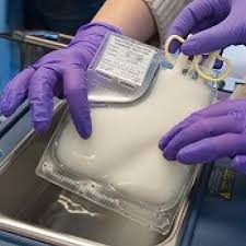 The modified cells are returned to the patient's body, a process that takes less than 10 minutes. Treatment Guidelines For Car T Cell Therapy Mdedge Hematology And Oncology