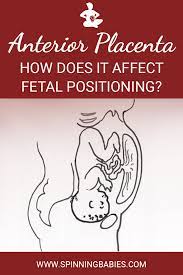 Anterior Placenta What It Means For You And Your Baby Spinning Babies Anterior Placenta Spinning Babies Placenta