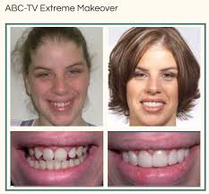 Find + book online in just a few clicks. Center For Cosmetic Dentistry 324 Greece Ridge Center Dr Rochester Ny Dentists Mapquest