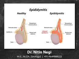 Pin On Urology