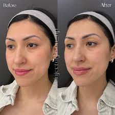 Jason Tye DNP, FNP-c