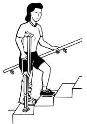12 Tips For Stair Climbing With Crutches Upmc Healthbeat Stair Climbing Crutches Broken Ankle