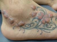 According to some people on reddit, uv ink tattoos are perfectly safe, and there is no scientific proof that they can cause cancer. In Addition To Regret Tattoos Can Pose Serious Health Risks Huffpost
